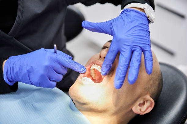 Best Emergency Gum Treatment in Rancho Tehama Reserve, CA